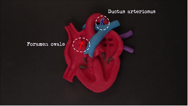 Medical Education - tacky cardia 1