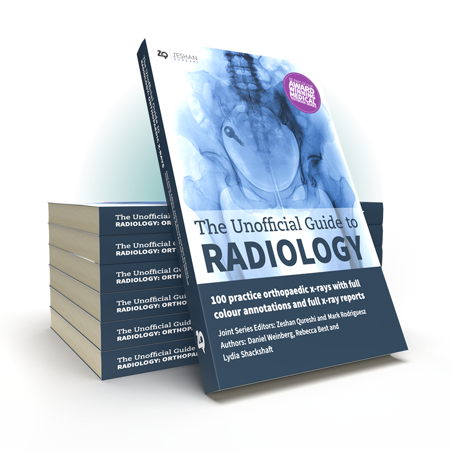 Unofficial Guide to Radiology 100 OXR